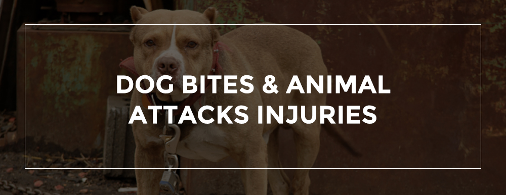 Sacramento Dog Bite Attorney | Dangerous Dog Bite Injury Attorney