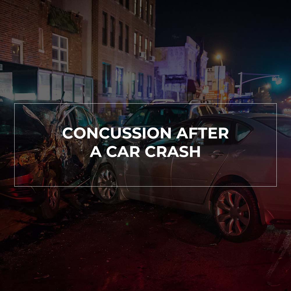 Concussion After a Car Crash