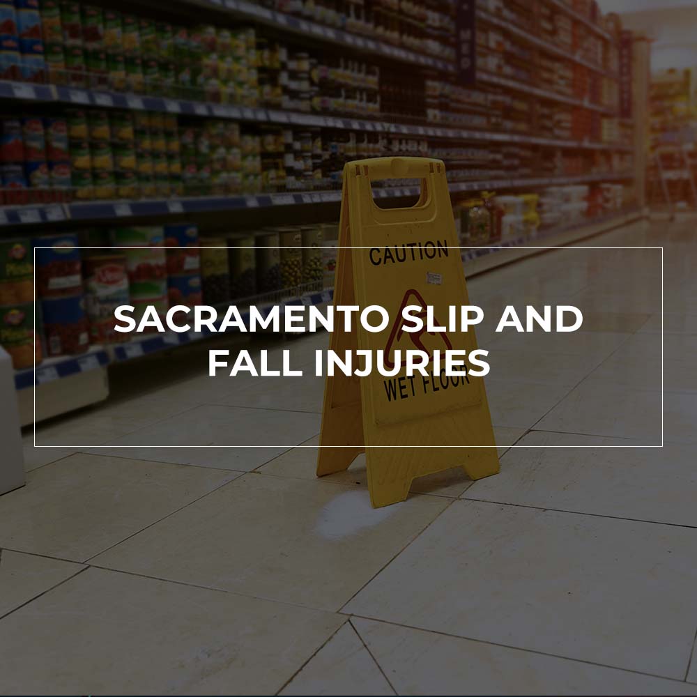 Sacramento Slip and Fall Injuries